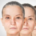 The benefits of collagen for reducing wrinkles and promoting anti-aging