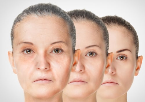 The benefits of collagen for reducing wrinkles and promoting anti-aging